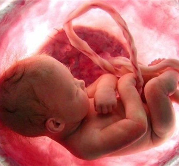 پاسخ استعلام اداره کل حقوقی قوه قضاییه درباره پرداخت دیه جنین دختر